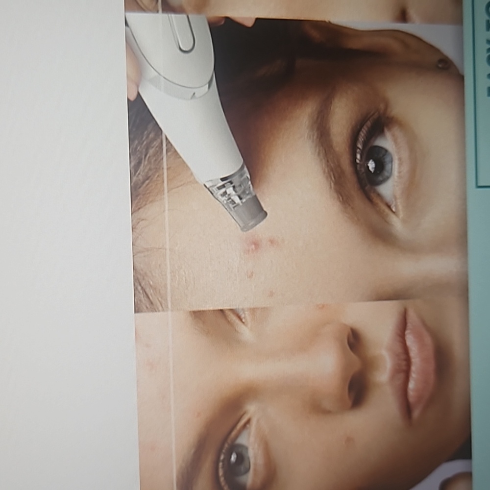 Conair, Microdermabrasion beauty tool - Picture 2 of 11